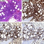 Transferrin Receptor Antibody in Immunohistochemistry (IHC)
