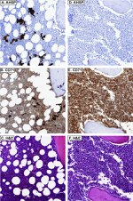 Transferrin Receptor Antibody in Immunohistochemistry (IHC)