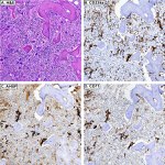 Transferrin Receptor Antibody in Immunohistochemistry (IHC)