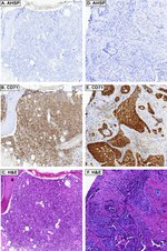 Transferrin Receptor Antibody in Immunohistochemistry (IHC)