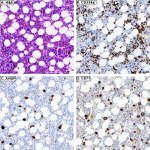 Transferrin Receptor Antibody in Immunohistochemistry (IHC)