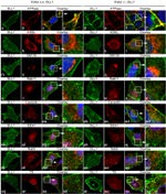 Transferrin Receptor Antibody in Immunocytochemistry (ICC/IF)