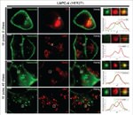 Transferrin Receptor Antibody in Immunocytochemistry (ICC/IF)