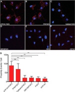 Transferrin Receptor Antibody in Immunocytochemistry (ICC/IF)