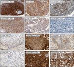 Transferrin Receptor Antibody in Immunohistochemistry (IHC)