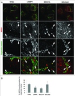 Transferrin Receptor Antibody in Immunocytochemistry (ICC/IF)