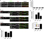 Transferrin Receptor Antibody in Immunohistochemistry (IHC)