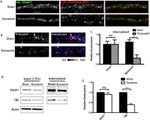 Transferrin Receptor Antibody in Immunohistochemistry (IHC)