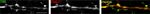 Transferrin Receptor Antibody in Immunohistochemistry (IHC)