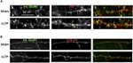 Transferrin Receptor Antibody in Immunohistochemistry (IHC)
