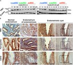 Transferrin Receptor Antibody in Western Blot, Immunohistochemistry (WB, IHC)