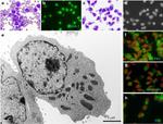 Transferrin Receptor Antibody in Immunocytochemistry (ICC/IF)