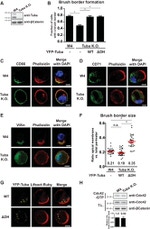 Transferrin Receptor Antibody in Immunocytochemistry (ICC/IF)