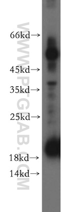 TFF2 Antibody in Western Blot (WB)