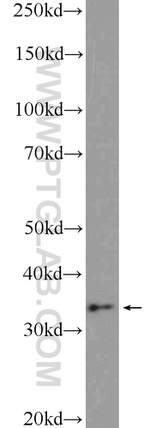 CHMP4B Antibody in Western Blot (WB)