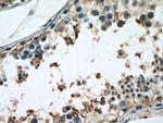 PGK2 Antibody in Immunohistochemistry (Paraffin) (IHC (P))