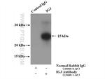 IGJ Antibody in Immunoprecipitation (IP)
