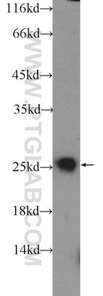 IGJ Antibody in Western Blot (WB)
