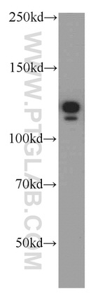 NEDD4L Antibody in Western Blot (WB)