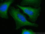 HERC4 Antibody in Immunocytochemistry (ICC/IF)