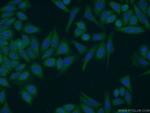 HERC4 Antibody in Immunocytochemistry (ICC/IF)