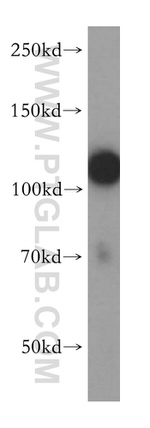 HERC4 Antibody in Western Blot (WB)