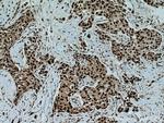 IRF2BP1 Antibody in Immunohistochemistry (Paraffin) (IHC (P))