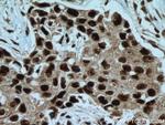 IRF2BP1 Antibody in Immunohistochemistry (Paraffin) (IHC (P))