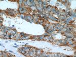 FMO5 Antibody in Immunohistochemistry (Paraffin) (IHC (P))