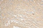 Calcyon Antibody in Immunohistochemistry (Paraffin) (IHC (P))