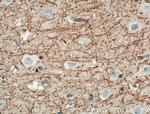 DGCR2 Antibody in Immunohistochemistry (Paraffin) (IHC (P))