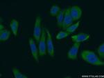 LARP1 Antibody in Immunocytochemistry (ICC/IF)
