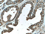 LARP1 Antibody in Immunohistochemistry (Paraffin) (IHC (P))