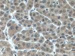 LARP1 Antibody in Immunohistochemistry (Paraffin) (IHC (P))