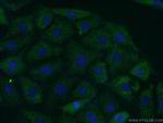 Carboxypeptidase E Antibody in Immunocytochemistry (ICC/IF)