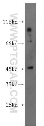 PNCK Antibody in Western Blot (WB)