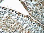 LSS Antibody in Immunohistochemistry (Paraffin) (IHC (P))