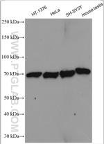 LSS Antibody in Western Blot (WB)
