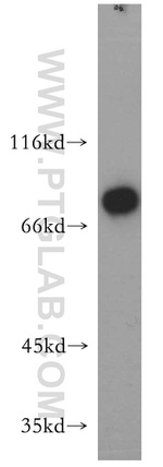 LSS Antibody in Western Blot (WB)