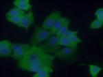 CCDC6 Antibody in Immunocytochemistry (ICC/IF)