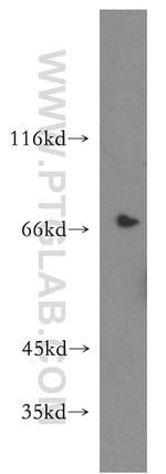 SLC9A9 Antibody in Western Blot (WB)
