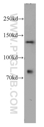 TTF2 Antibody in Western Blot (WB)