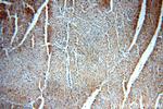 VPS34 Antibody in Immunohistochemistry (Paraffin) (IHC (P))