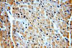 VPS34 Antibody in Immunohistochemistry (Paraffin) (IHC (P))