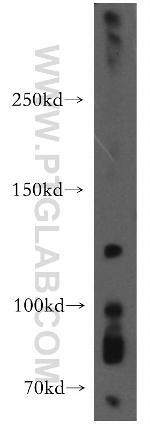 EPHA8 Antibody in Western Blot (WB)
