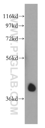 AUP1 Antibody in Western Blot (WB)