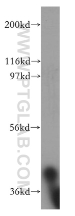 AUP1 Antibody in Western Blot (WB)
