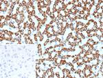 CPS1/Carbamoyl-Phosphate Synthetase (Hepatocellular Marker) Antibody in Immunohistochemistry (Paraffin) (IHC (P))