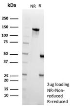 CPS1/Carbamoyl-Phosphate Synthetase (Hepatocellular Marker) Antibody in SDS-PAGE (SDS-PAGE)
