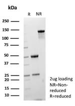 CPS1/Carbamoyl-Phosphate Synthetase (Hepatocellular Marker) Antibody in SDS-PAGE (SDS-PAGE)